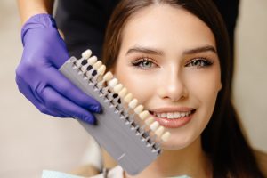 Dentist choosing veneer shade for patient