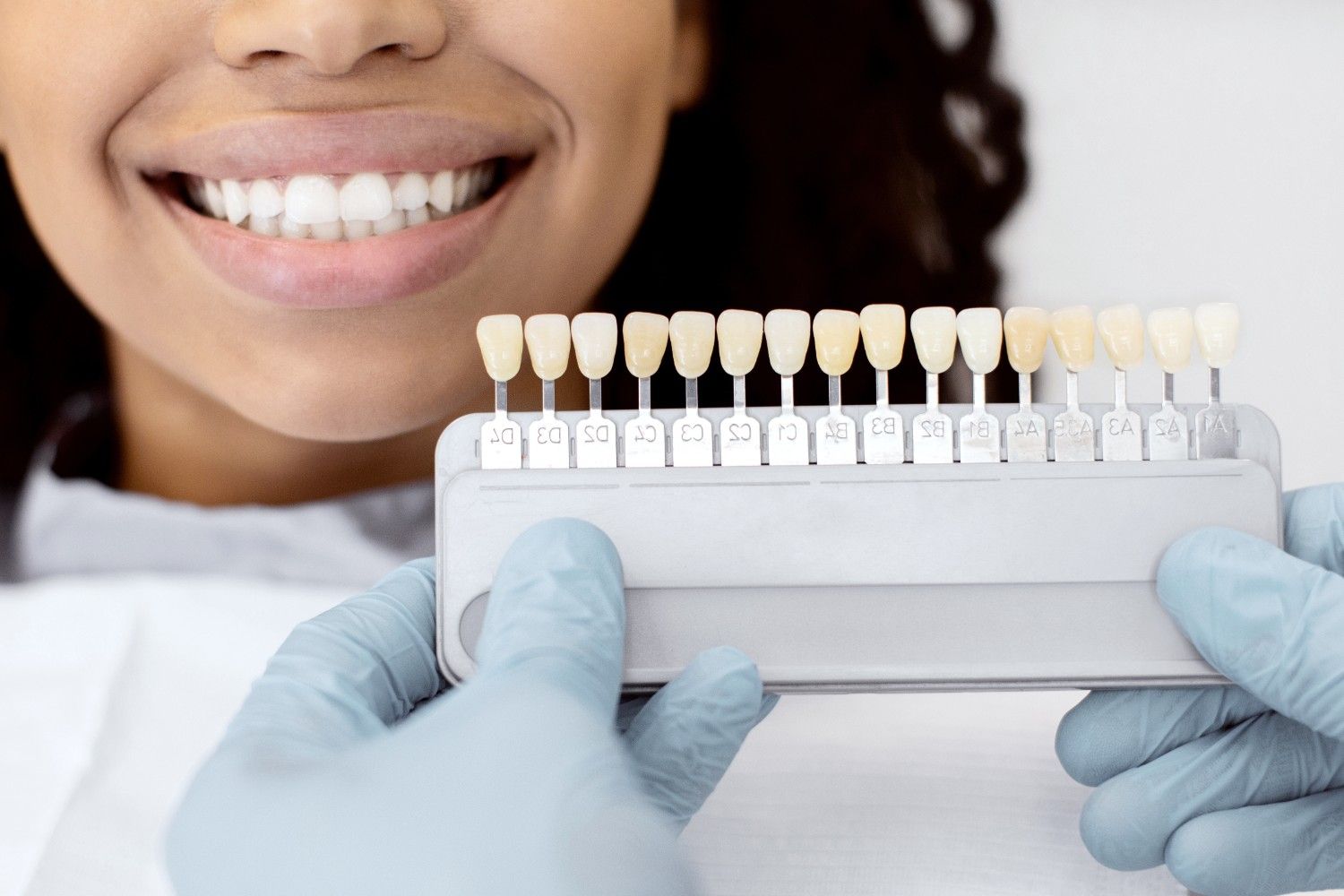 Dentist showing a set of veneers to a patient